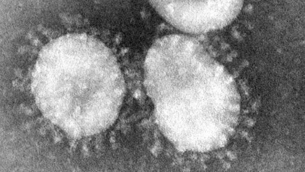 Dos mujeres mayores de 60 años son los primeros casos de coronavirus en Bolivia