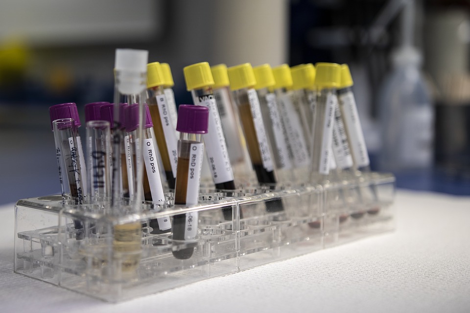 Más de 50 tipos de cáncer se pueden detectar con un nuevo método a través de análisis de sangre