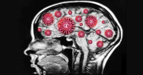 ¿El COVID-19 también podría afectar al cerebro?