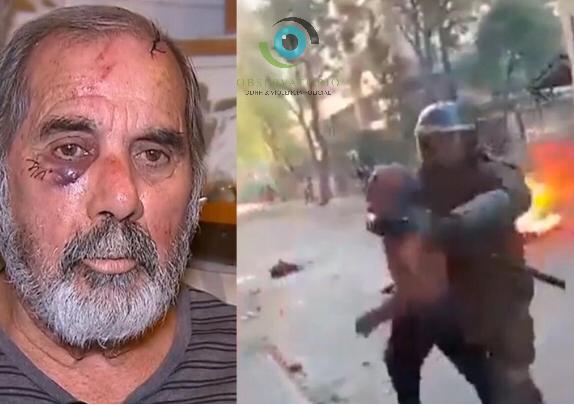Observatorio de DDHH y Violencia Policial presentó querella contra Carabineros por brutal agresión a adulto mayor en Santiago