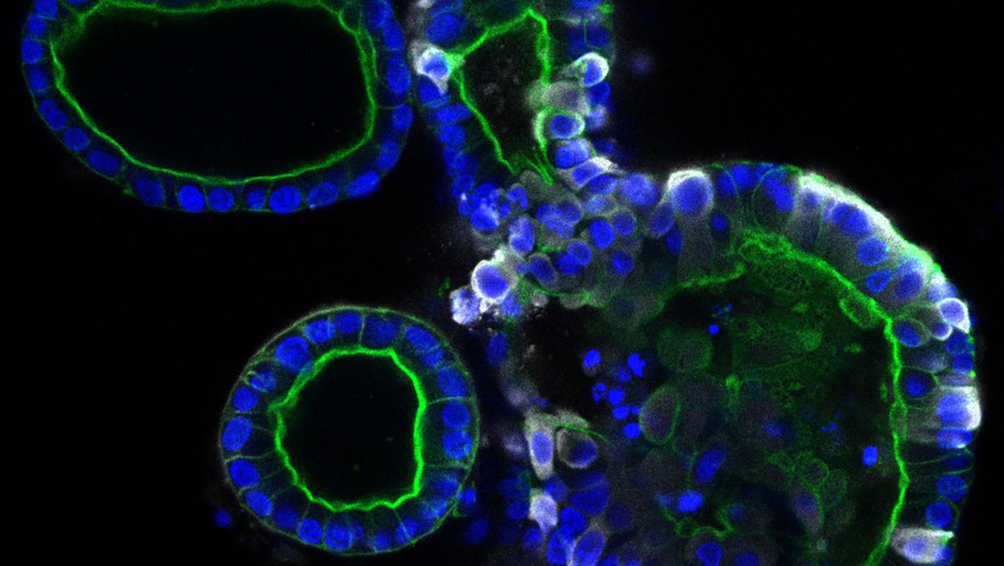 (Fotos) Así es cómo el coronavirus puede infectar y multiplicarse en el intestino