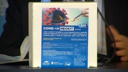 Argentina crea test que detecta el COVID-19 en una hora con 98% de eficacia