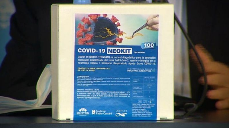 Argentina crea test que detecta el COVID-19 en una hora con 98% de eficacia
