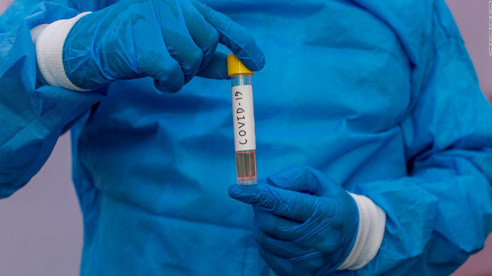 Rusia alerta ante 100 cepas del nuevo coronavirus