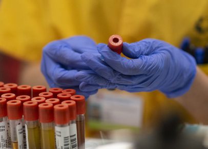 Región de Ñuble reportó 41 contagios y un nuevo fallecido con COVID-19