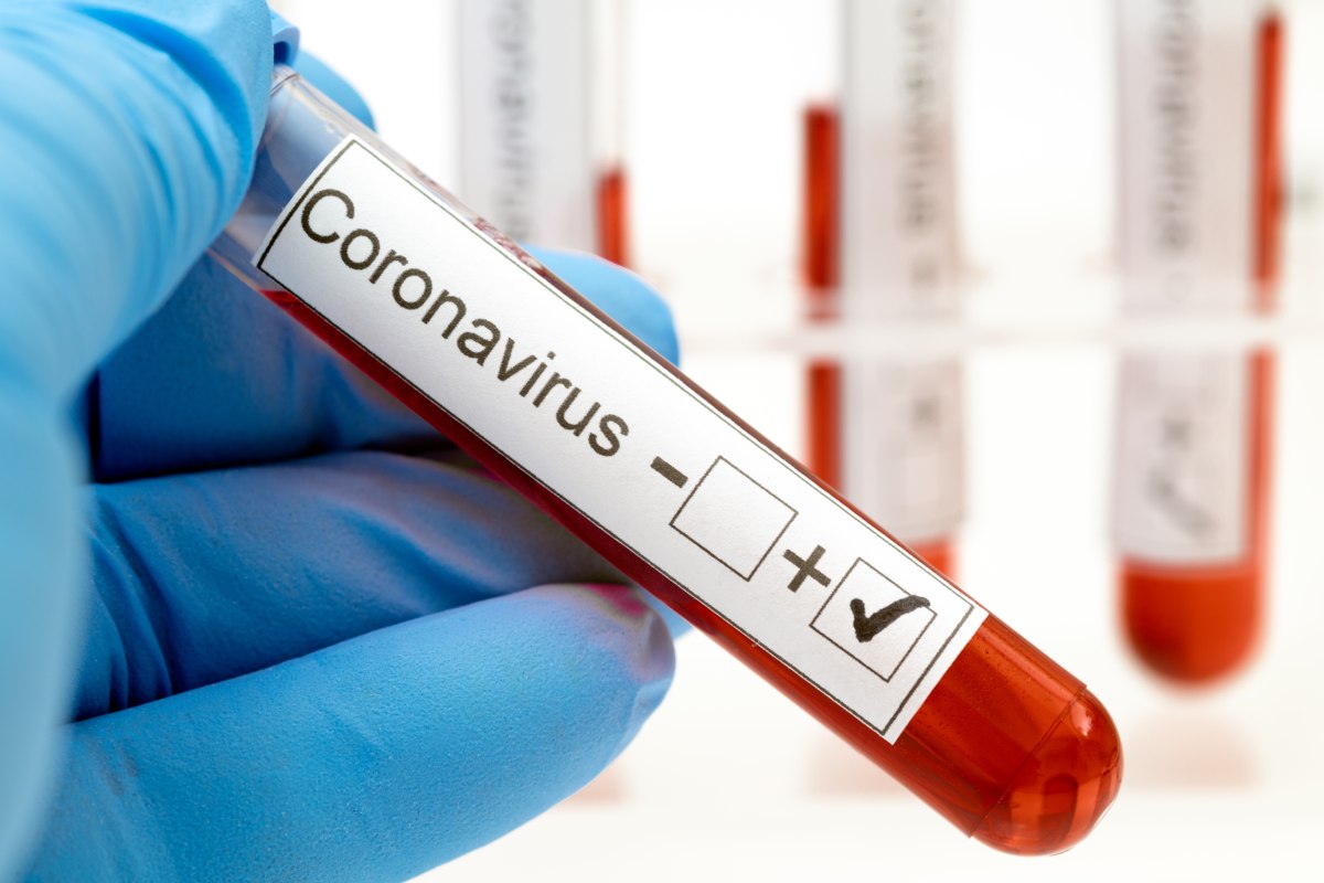 Estudio revela que inmunidad al COVID-19 podría perderse en meses