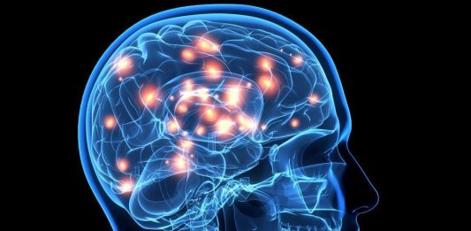 cerebro