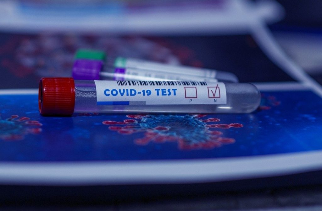 Vacuna de EE. UU. contra COVID-19 avanza según lo previsto y da primeros buenos resultados