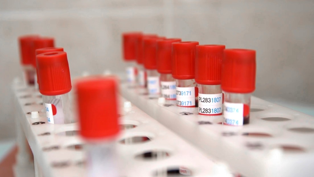 Rusia comenzará en septiembre suministros internos de grandes lotes de vacuna anticovid
