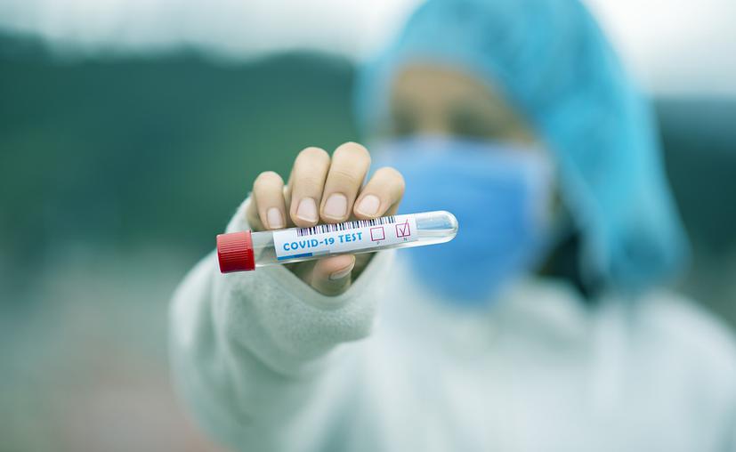 Un estado de Brasil probará en octubre vacuna rusa contra el COVID-19