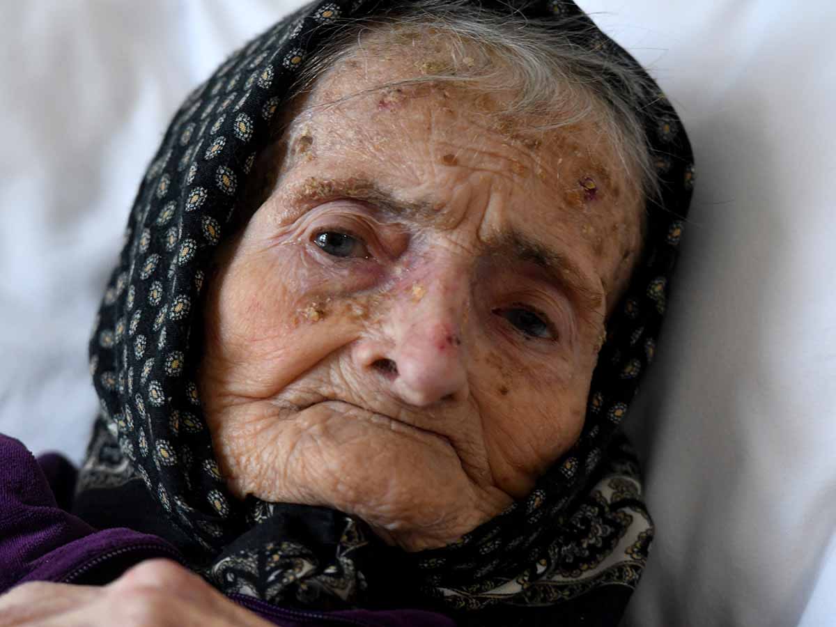 Asombroso: Mujer de 99 años superó el Covid-19 en Croacia