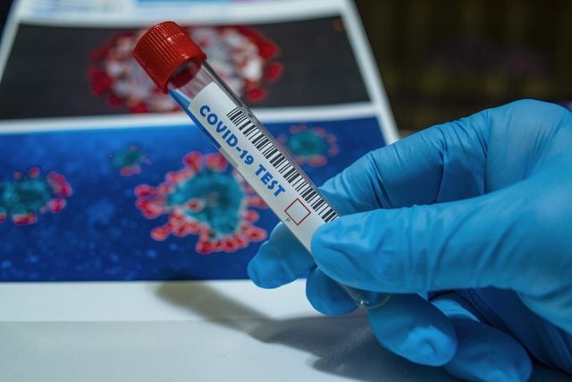 Covid-19: Estudio internacional evaluará impacto de la crisis sanitaria en personas con VIH