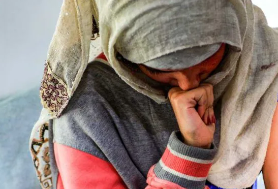 Joven yemení fue obligada a casarse a los 12 años y su esposo le quemó la cara con ácido
