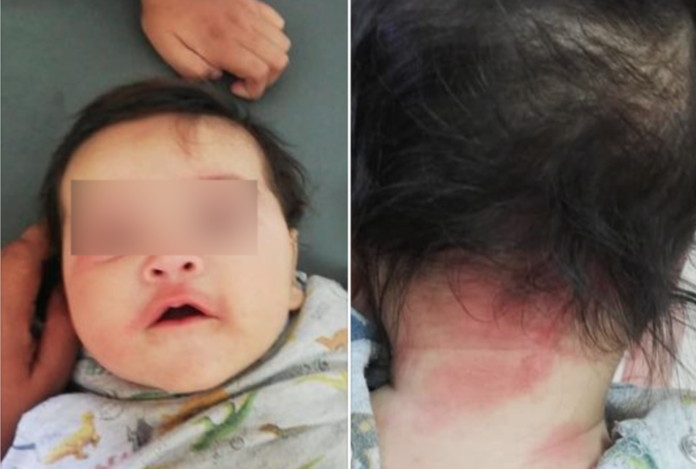 VIDEO: Carabineros rocía arbitrariamente gas pimienta en feria de Bajos de Mena, afectando a niños y dejando quemaduras en un bebé