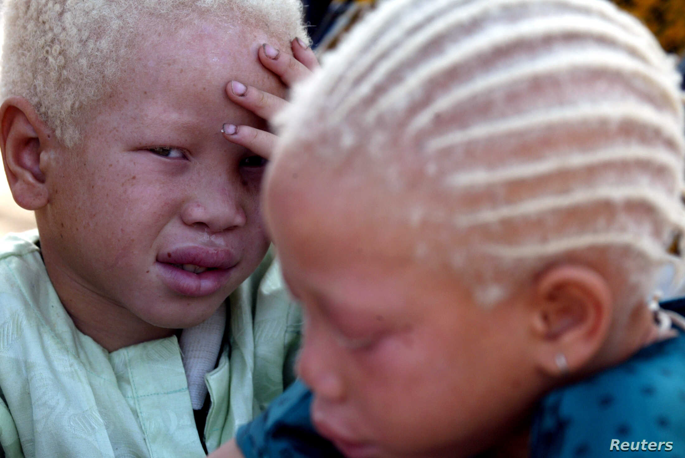 Durante la pandemia se dispararon asesinatos de personas albinas