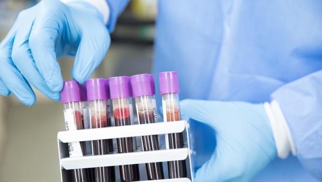 Desarrollan primer test de sangre que detecta el cáncer y si se ha diseminado por el cuerpo
