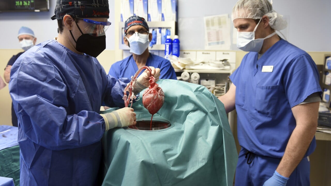 Realizan con éxito primer trasplante de corazón de cerdo a humano en EE.UU.