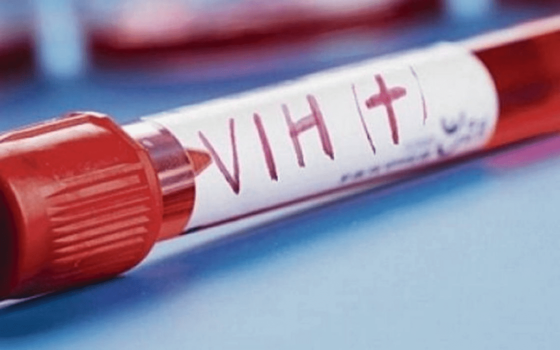 Riesgo de transmisión superior: detectan nueva variante del VIH en Países Bajos