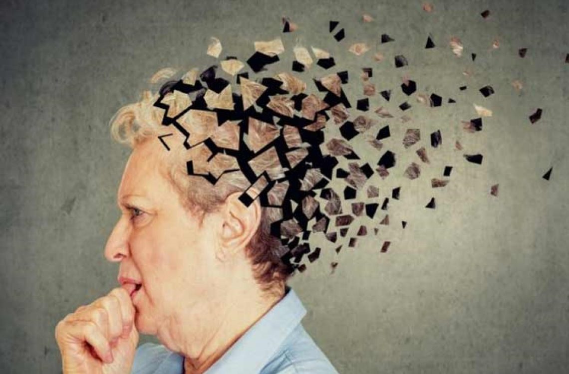 Alzheimer: Estudio revela que progresión de la enfermedad podría ser distinta entre machos y hembras