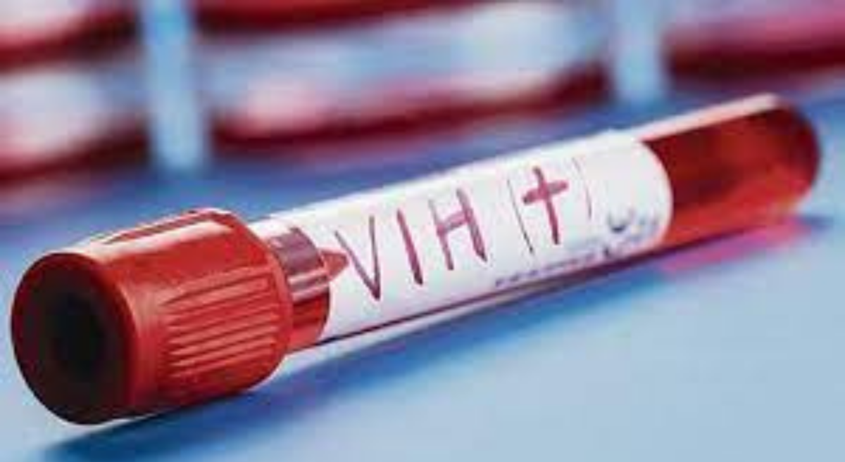 Testeos de VIH se tomarán de manera gratuita este viernes