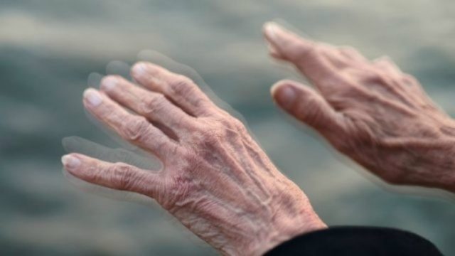 parkinson