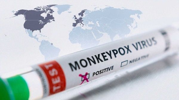 La Viruela del mono se ha extendido a mas de 20 países