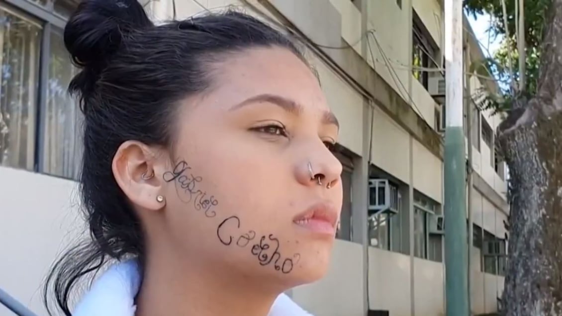 ¡Alerta machista Brasil!: Joven denunció a expareja por tatuarle a la fuerza su nombre en el rostro