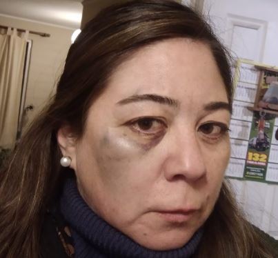 CChDH presentó querella querella contra carabineros por apremios ilegítimos en contra de la periodista María Soledad Osorio