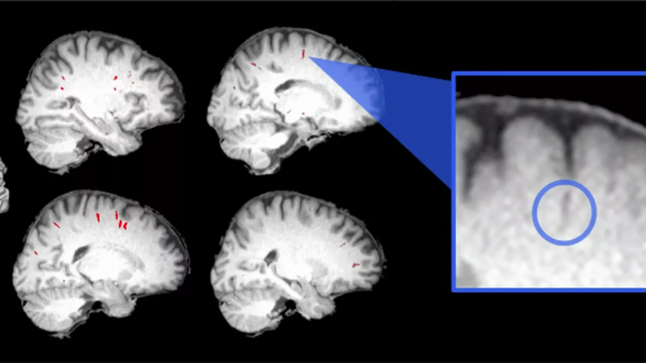 Investigadores revelan nuevos efectos que tienen las estadías en el espacio sobre el cerebro humano