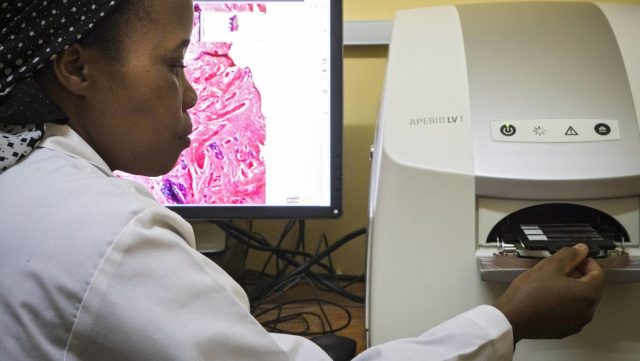 Detectan extraña enfermedad en Tanzania