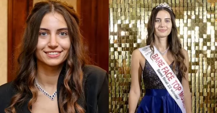 Rompiendo estándares de belleza: por primera vez en 94 años de certamen una finalista de Miss Inglaterra compite sin maquillaje