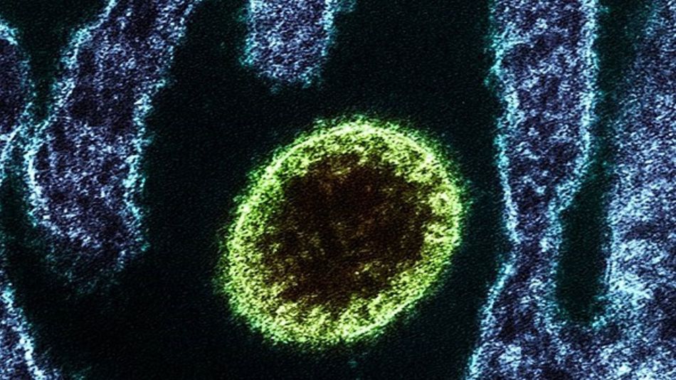 Virus «Langya» detectado en China también causa síntomas respiratorios
