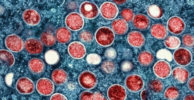 Renombran al virus de la viruela del mono como «mpox»
