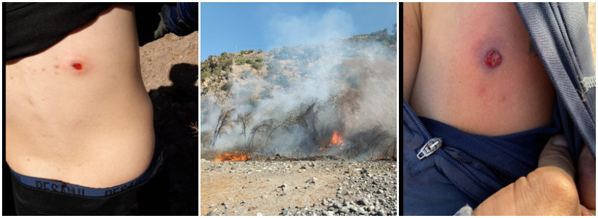 <strong>Conflicto ambiental con Minera Los Pelambres: pobladores de Panguecillo son reprimidos por carabineros mientras MLP se niega al diálogo</strong>