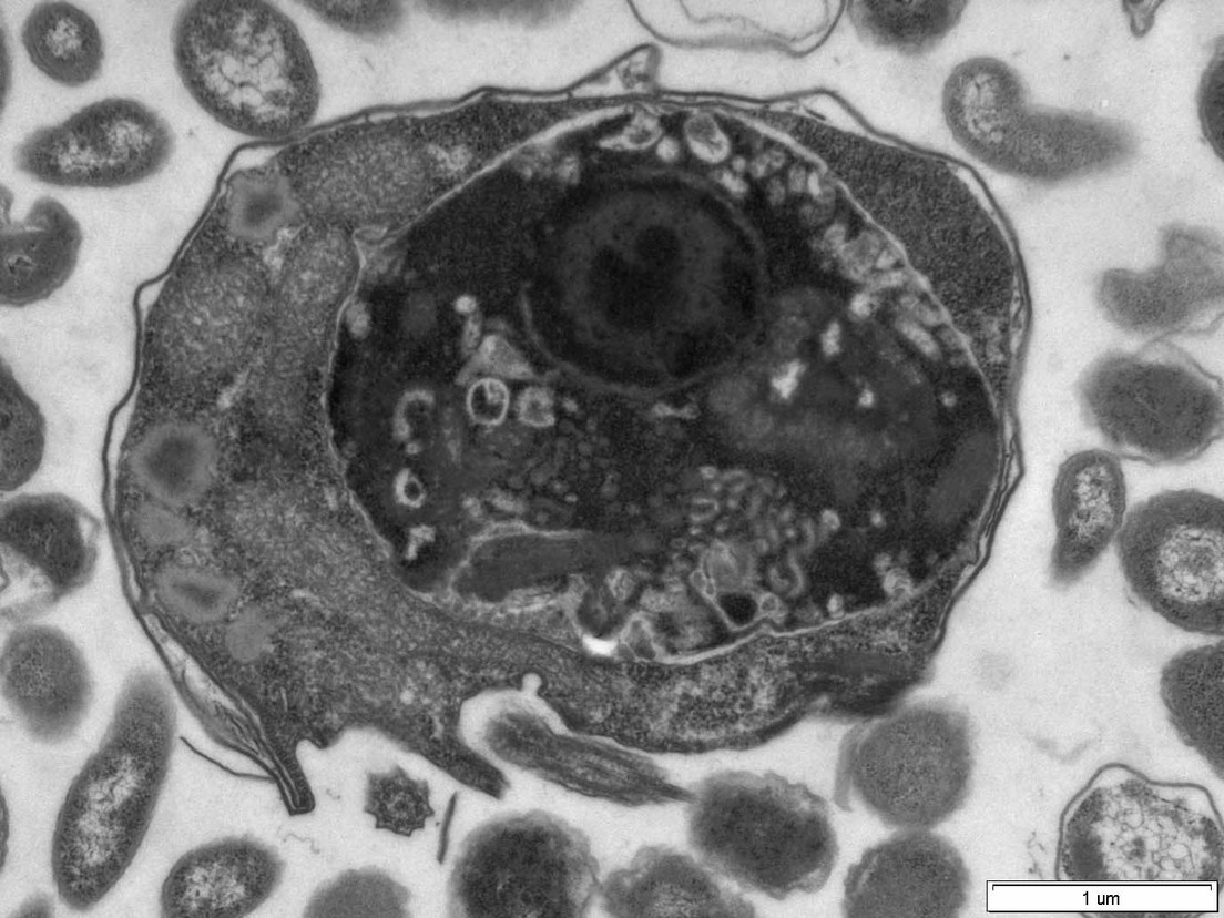 «Leones del mundo»: descubren dos nuevos grupos de depredadores microbianos