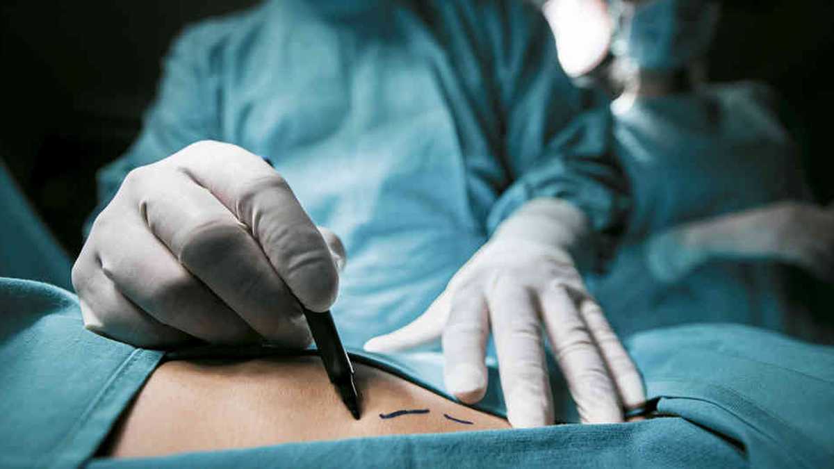 ¡Ley de especialidades médicas ahora! Sólo en diciembre han muerto dos mujeres por cirugías cuestionadas