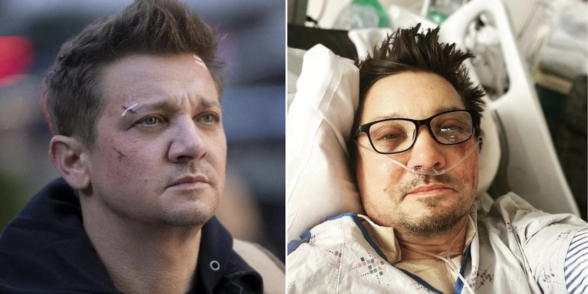 Jeremy Renner es dado de alta tras dos semanas en la UCI: podría tardar hasta dos años en recuperarse