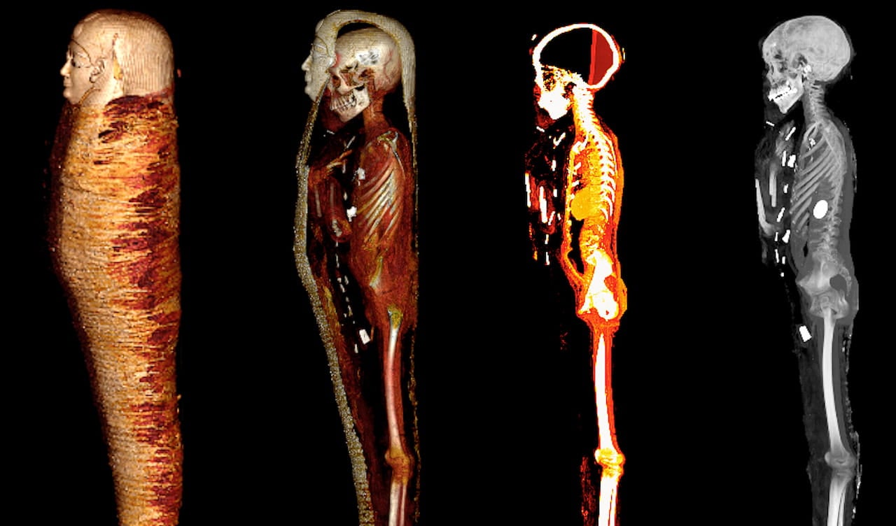 Escaneo digital revela secretos de una momia adolescente de hace 2.300 años