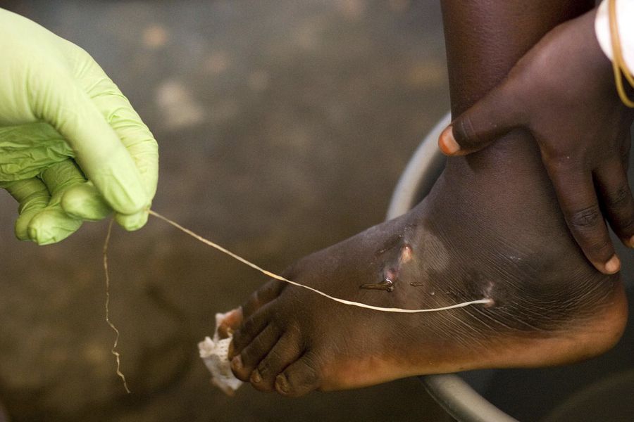 Dracunculosis sería la primera enfermedad humana en ser erradicada sin vacuna o medicamento