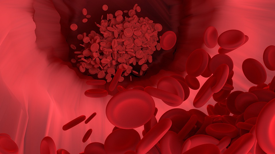 Primera evidencia: encuentran microplásticos en los vasos sanguíneos humanos