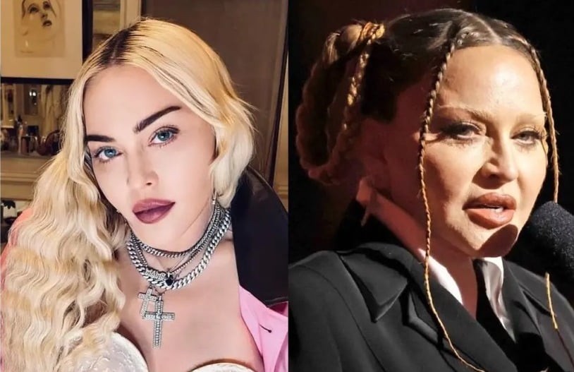 Madonna responde ante las duras críticas por su nuevo rostro
