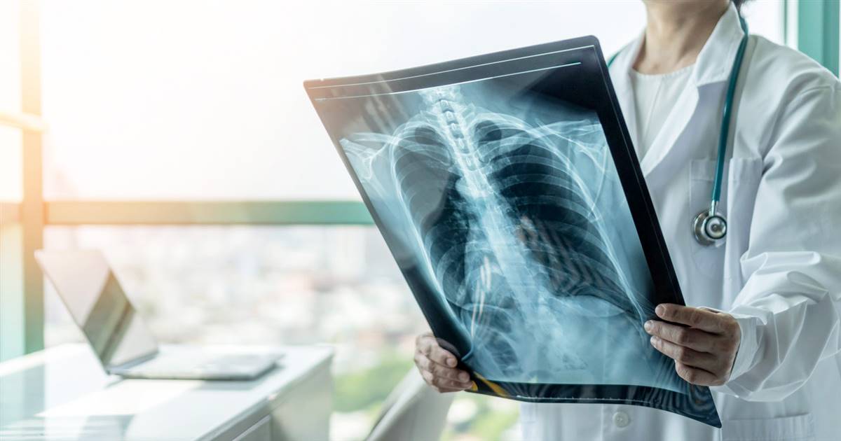 tuberculosis-mujer