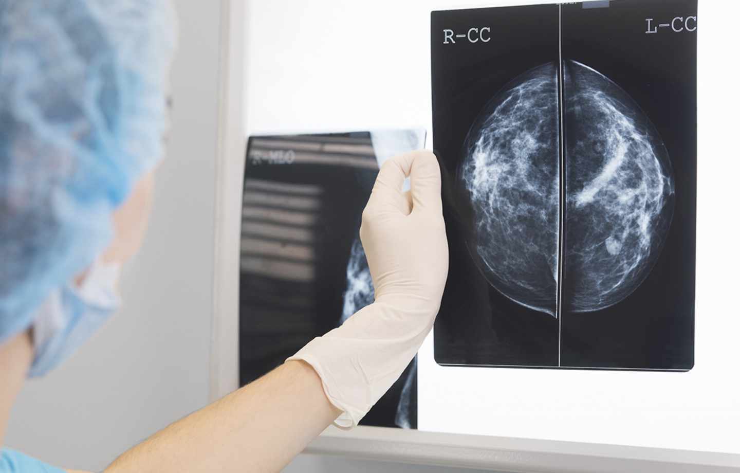 Decenas de mujeres erróneamente diagnosticadas con cáncer de mamas: Radiólogos fueron suplantados para emitir firmas e informes