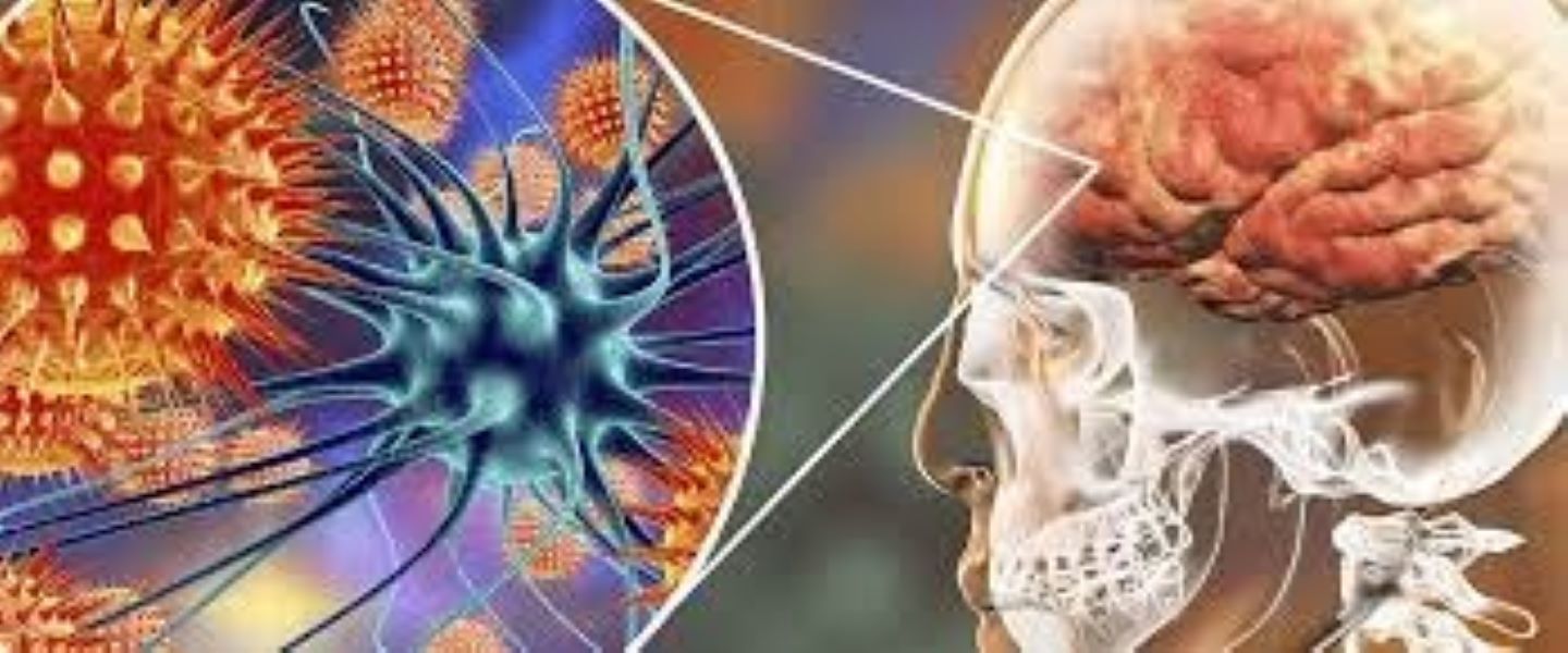 Salud federal identifica 23 casos de meningitis en hospitales privados
