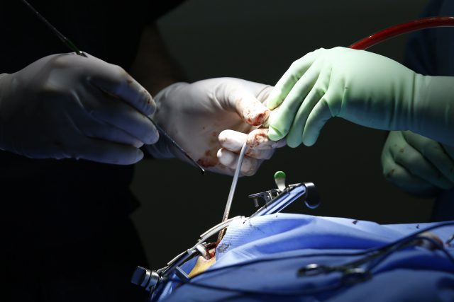 IMSS de BCS deja pinzas dentro de paciente; deberá reparar daños