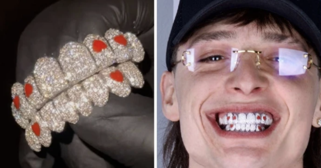 Cuántos millones cuesta la nueva dentadura de diamantes de Peso Pluma