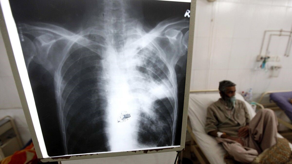 Por tuberculosis, instalan cerco sanitario en penal de Chihuahua