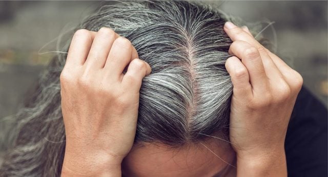Los 5 alimentos ideales para no tener canas