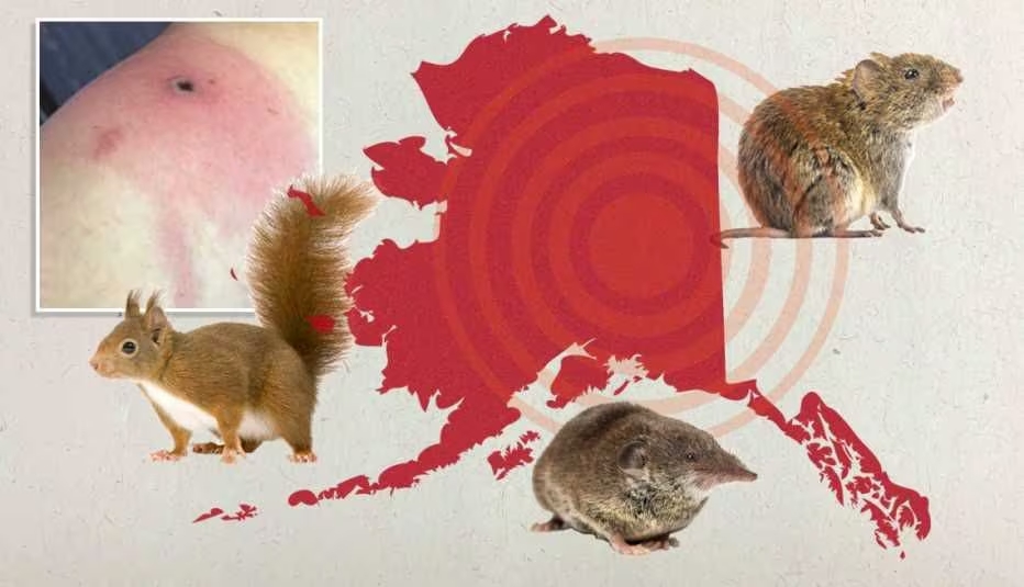 Nuevo virus, Viruela de Alaska, reporta primer caso mortal en un humano