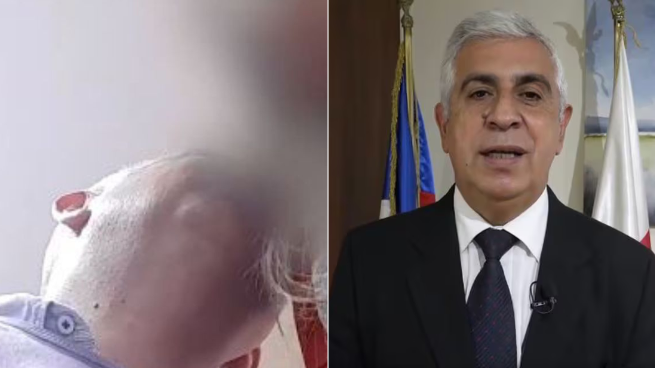 Municipalidad de Laja confirma que alcalde que abusó sexualmente de funcionaria permanecerá en el cargo